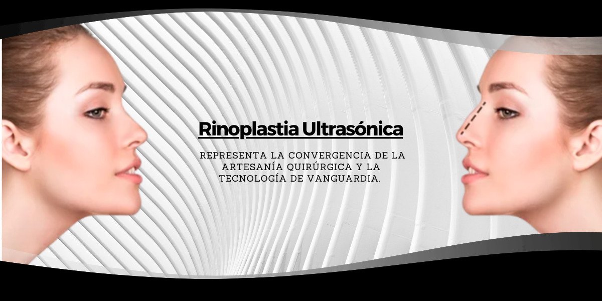 Rinoplastia Ultrasónica