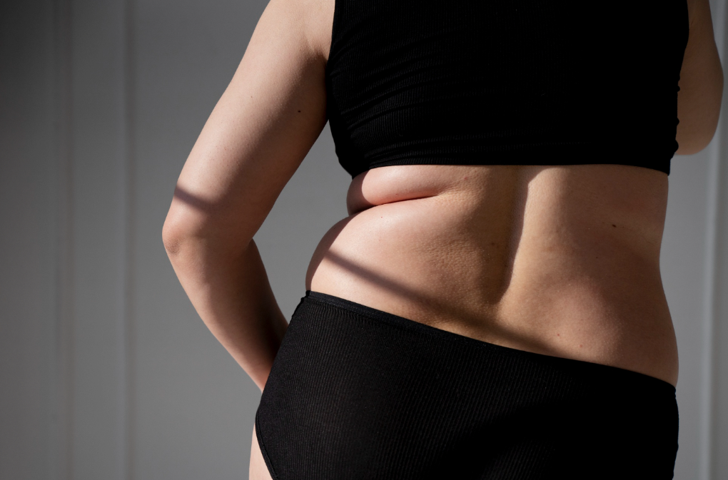 love handles