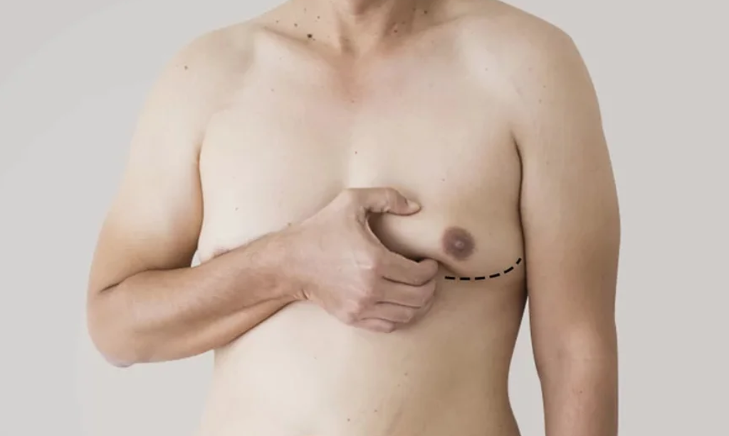 how to get rid of man boobs