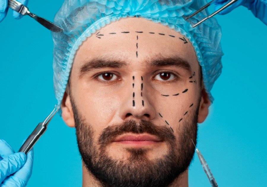 plastic surgery for men