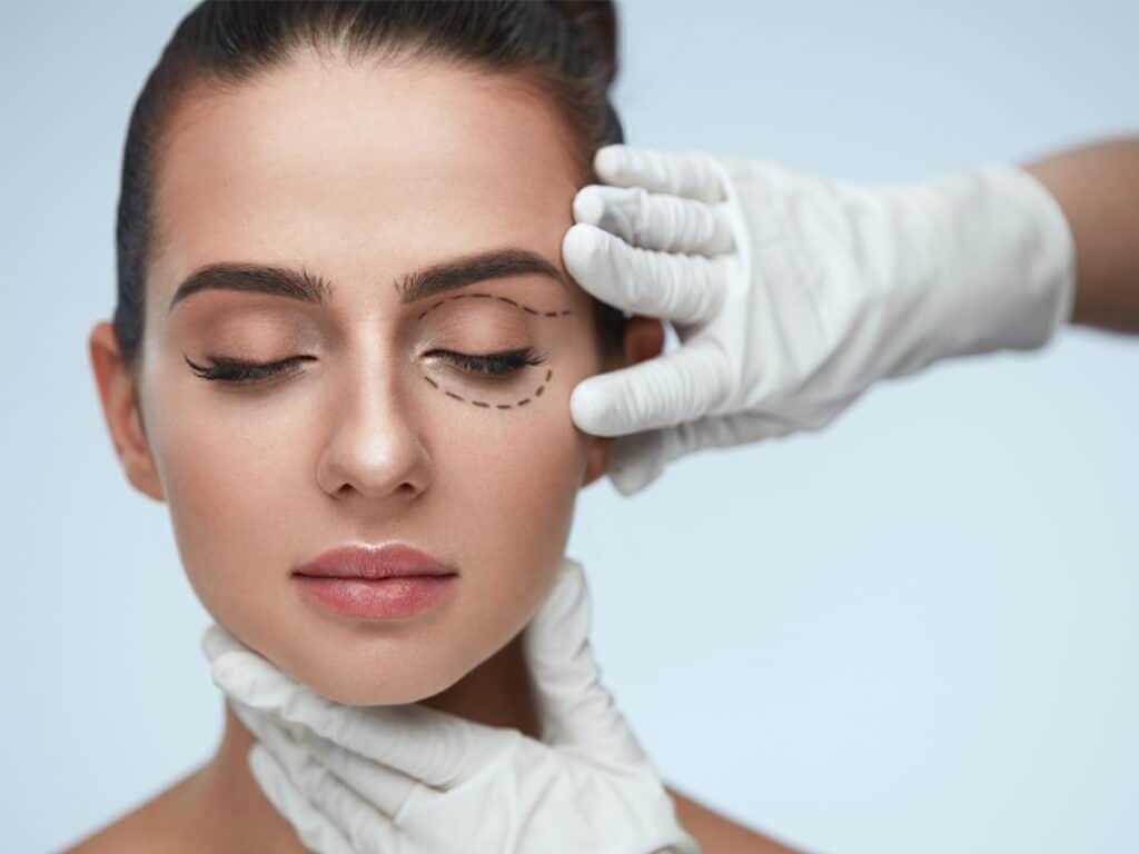 eyelid surgery